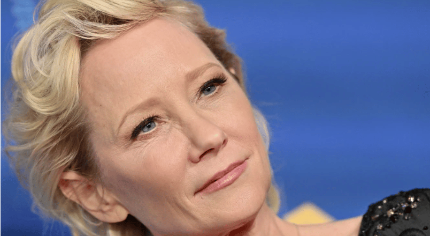Report: Anne Heche In “Extremely Critical Condition”